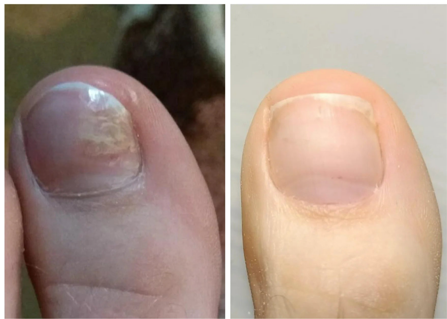 NAILSOFTHEDAY ONISTOP – Regenerating Oil, 8 ml