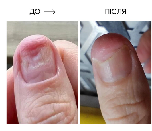 NAILSOFTHEDAY ONISTOP – Regenerating Oil, 8 ml